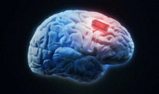 Universitatea Connecticut a dezvoltat un implant pe creier ...